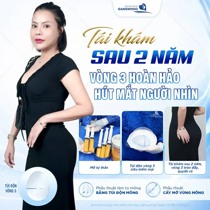Tái khám sau 2 năm vòng 3 hoàn hảo hút mắt người nhìn tôn đường cong xuất sắc cho cơ thể 