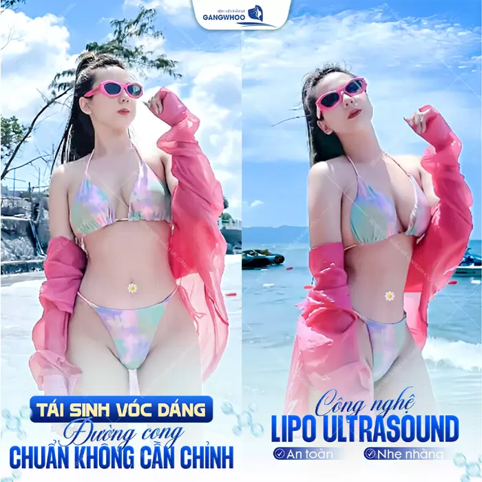 Bảng Giá Phẫu Thuật Thẩm Mỹ Làm Đẹp Tại Bệnh Viện Thẩm Mỹ Gangwhoo 7 tai sinh voc dang duong cong chuan khong can chinh