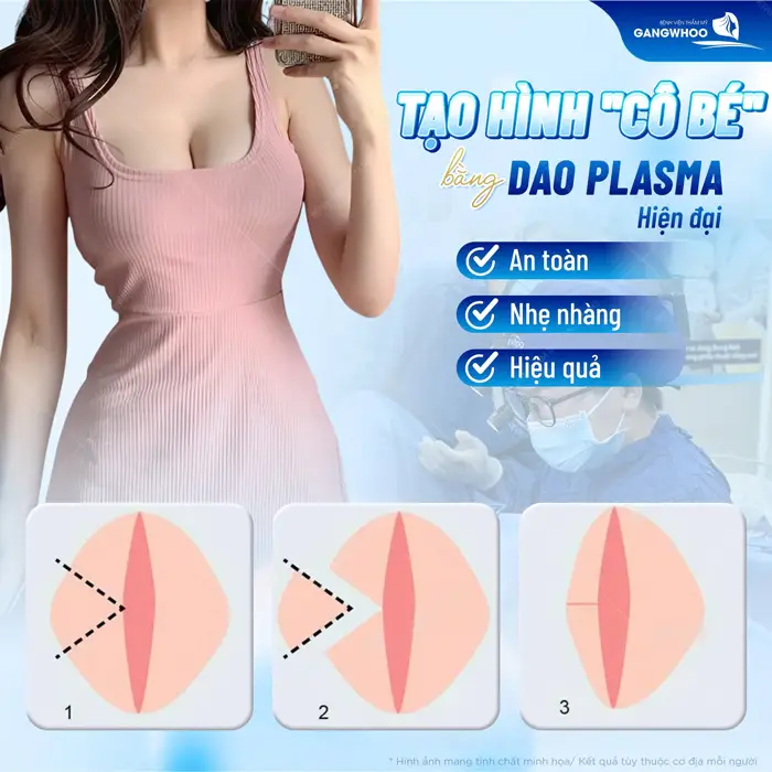 Tạo hình cô bé bằng công nghệ hiện đại kết quả an toàn, nhẹ nhàng và hiệu quả