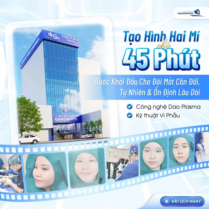 Cắt Mắt 2 Mí Có Để Lại Sẹo Không? Hướng Dẫn Chăm Sóc 1 Tạo ihfnh mắt 2 mí mắt đẹp chỉ sau 45 phút thực hiện an toàn và tự nhiên dài lâu