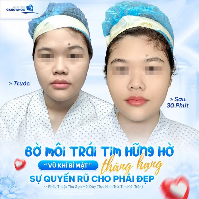 Tạo hình môi trái tim hờ hững "vũ khí" thăng hạng giải pháp cho sự quyến rũ cho phái đẹp