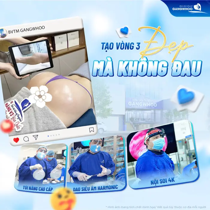 Nâng Mông Nội Soi "Tôn Vinh Vòng 3 Căng Tròn Quyến Rũ" 5 Tạo vòng 3 đẹp mà không đau với kỹ thuật và công nghệ hiện đại