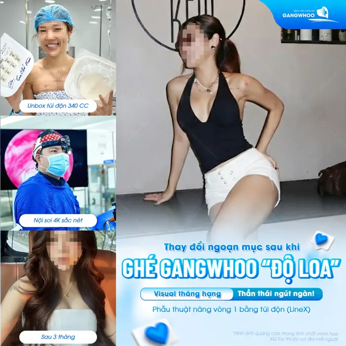 Top 15 Bác Sĩ Nâng Ngực Giỏi Tại TPHCM Nhiều Người Biết Đến 2 Thay đổi ngoạn mục sau "độ loa" ghé Gangwhoo nâng cấp vòng 1 đẹp chuẩn thần thái