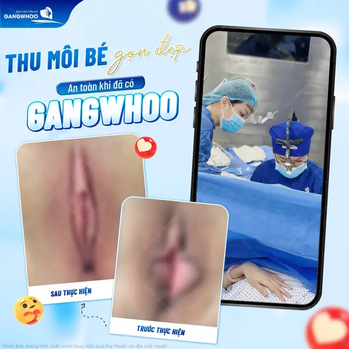 Hình ảnh môi be và môi lớn