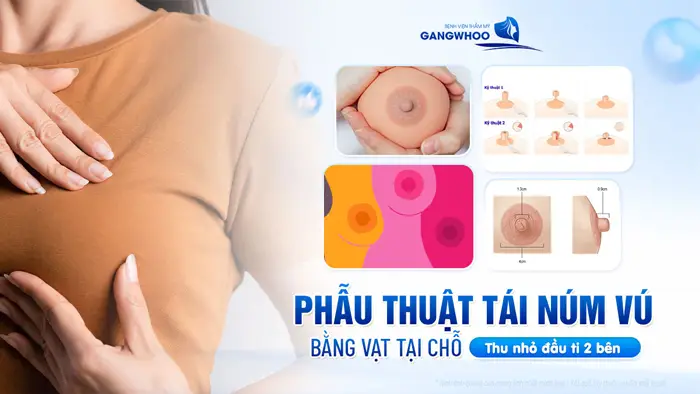 thu nho dau ti 2 ben