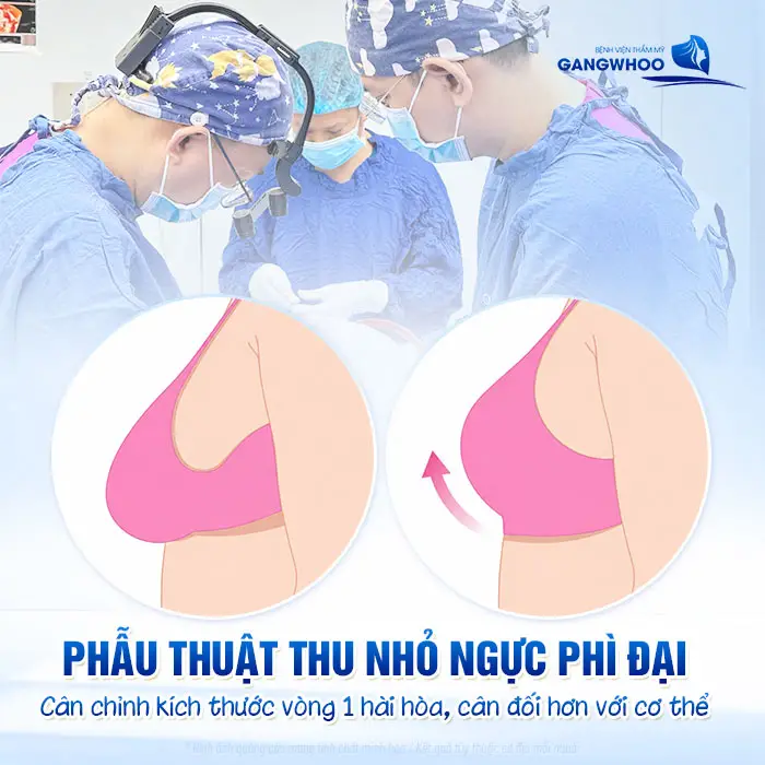 Phẫu Thuật Thu Nhỏ Ngực Phì Đại "Tinh Chỉnh Núi Đôi Gọn Gàng Cân Đối" 2 Phẫu Thuật Thu Nhỏ Ngực Phì Đại "Tinh Chỉnh Núi Đôi Gọn Gàng Cân Đối"