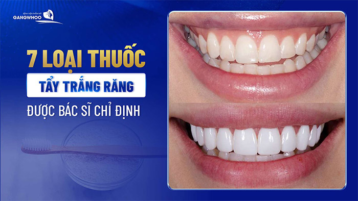 thuoc tay trang rang