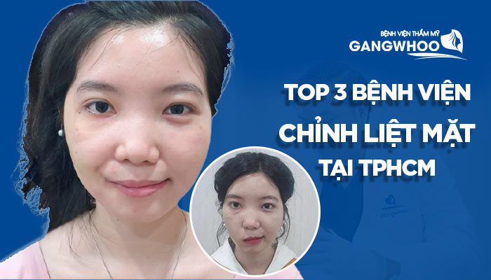 The 3 Best Facilities For Facial Palsy Treatment in Ho Chi Minh City