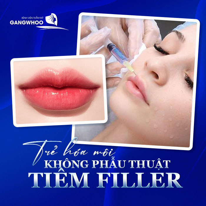 唇部年轻化——打造饱满迷人的双唇 2 Thẩm Mỹ Trẻ Hóa Môi