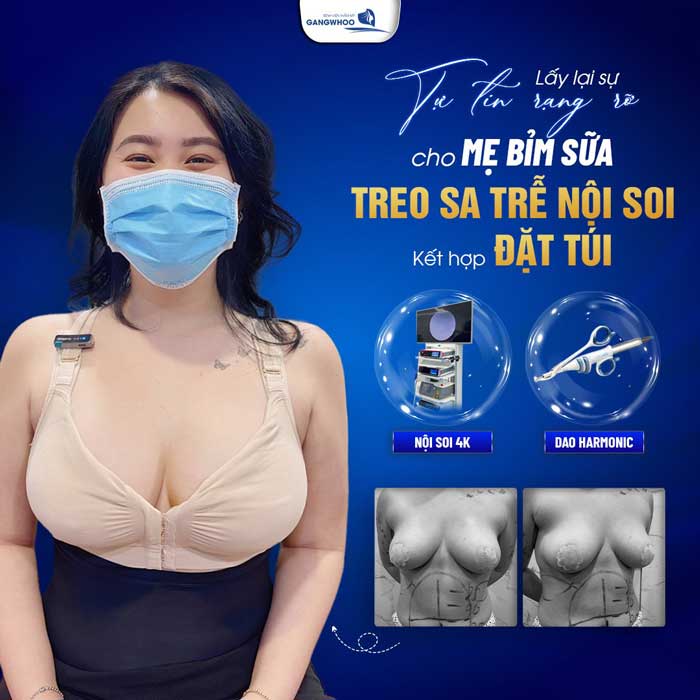 Treo ngực sa trễ tại Bệnh viện thẩm mỹ Gangwhoo được áp dụng nhiều công nghệ hiện đại