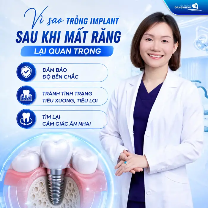 Trồng răng Implant sau khi mất răng vô cùng quan trọng đảm bảo độ bền chắc khôi phục chức năng ăn nhai