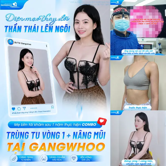 Địa Chỉ Nâng Ngực Dành Cho Việt Kiều Uy Tín Tại TPHCM 1 Diện mạo thay đổi thần thái lên ngôi sau trùng tu vòng 1 tại bệnh viện thẩm mỹ Gangwhoo