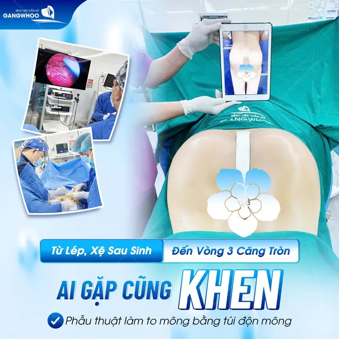 Từ lép, xệ sau sinh đến vòng 3 căng tròn ai gặp cũng khen nức nở