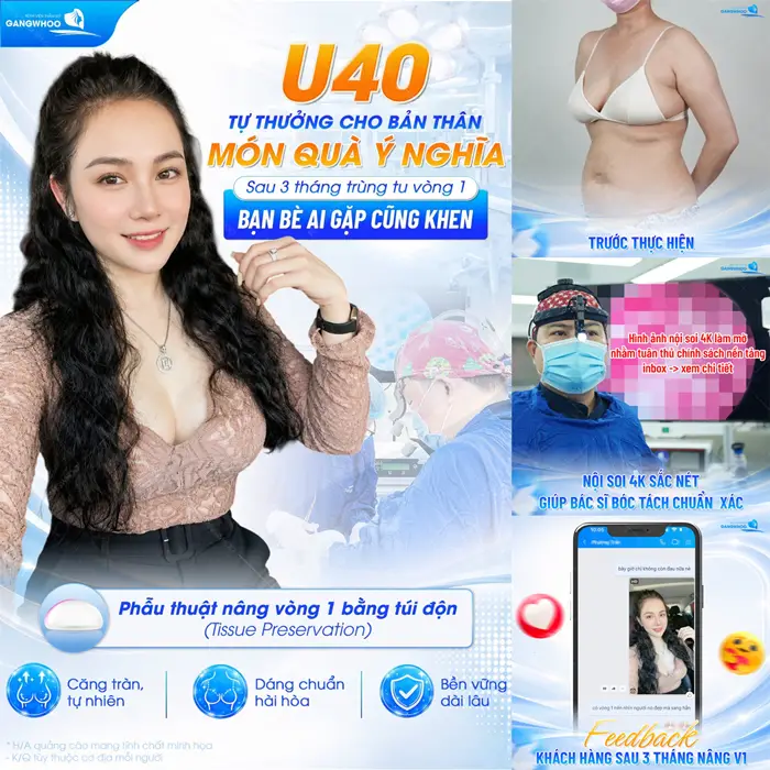 Phẫu thuật nâng ngực bằng túi độn sau 3 tháng gặp lại bạn bè ai cũng khen nức nở