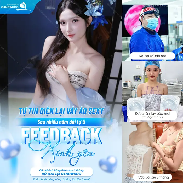 Tự tin diện lại váy dây sexy sau nhiều năm dài tự ti với Feedback xinh yêu sau phẫu thuật trùng tu vòng 1 tại BVTM Gangwhoo