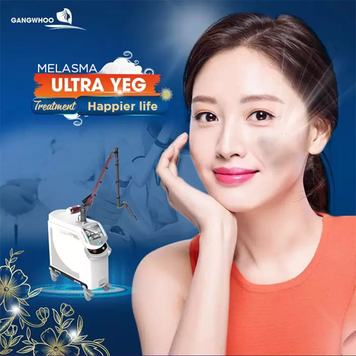 Ultra YEG Melasma Treatment - Say Goodbye To Melasma 2 ultra yeg melasma