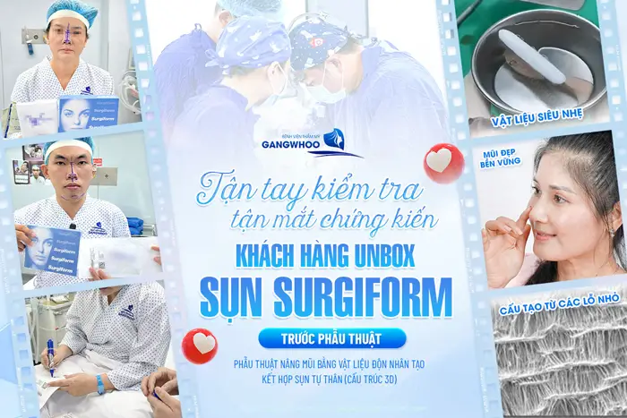 Khách Unbox sụn Surgiform trước phẫu thuật yên tâm về chất lượng sụn và độ an toàn 