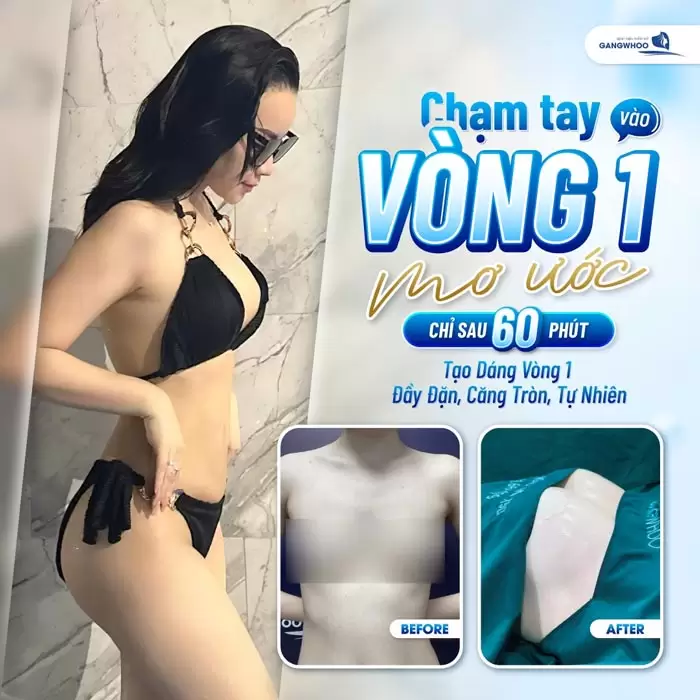 Nâng Ngực Nội Soi Túi Nano Chip Công Nghệ Harmonic Hàn Quốc 4 Vòng 1 đẹp mơ ước chỉ sau 60 phút thực hiện với vòng 1 tròn đầy, tự nhiên