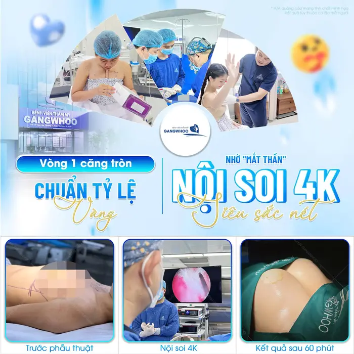 Vòng 1 căng tròn đẹp chuẩn tỷ lệ nhờ công nghệ nội soi hiện đại 