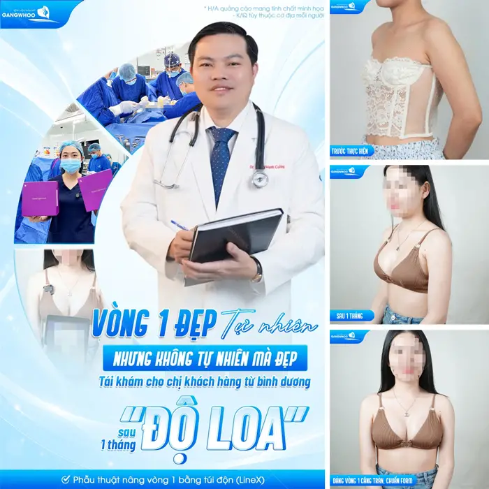 Phẫu Thuật Nội Soi Nâng Ngực (Nâng Ngực Nội Soi Túi Nano Chip) Công Nghệ Harmonic Hàn Quốc 4 Vòng 1 đẹp tự nhiên sau 1 tháng độ loa với kết quả đẹp xuất sắc hơn từng ngày