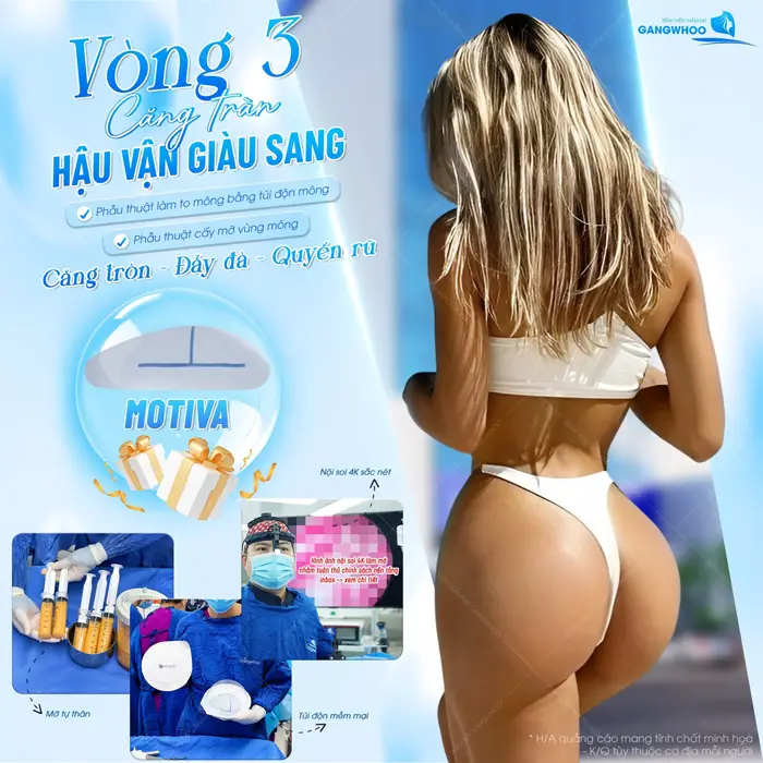 Vòng 3 căng tràn hậu vận giàu sang sau khi áp dụng công nghệ cấy mỡ nâng mông với sự hỗ trợ của nội soi 4K