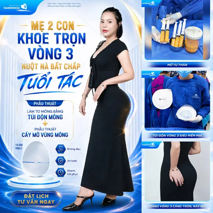 Phẫu Thuật Làm To Mông Bằng Túi Độn Mông (Nâng Mông Nội Soi Túi Ergonomic) 2 Mẹ 2 con khoe trọn dáng vòng 3 đẹp nuột nà bất chấp tuổi tác sau phẫu thuật làm to mông bằng túi độn