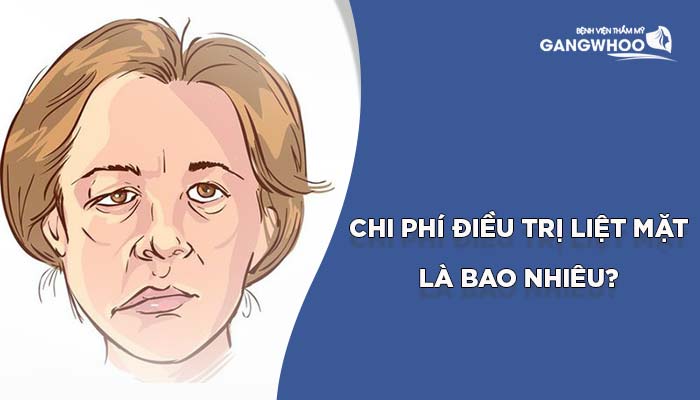 Chi phí điều trị liệt mặt là bao nhiêu?