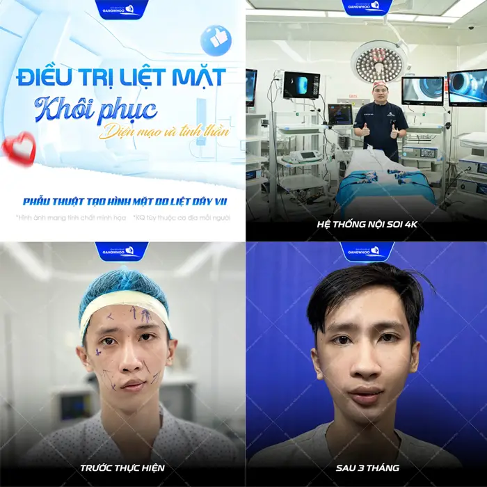Điều trị liệt mặt khôi phục diện mạo và tinh thần sau nhiều năm sống chung với biến chứng