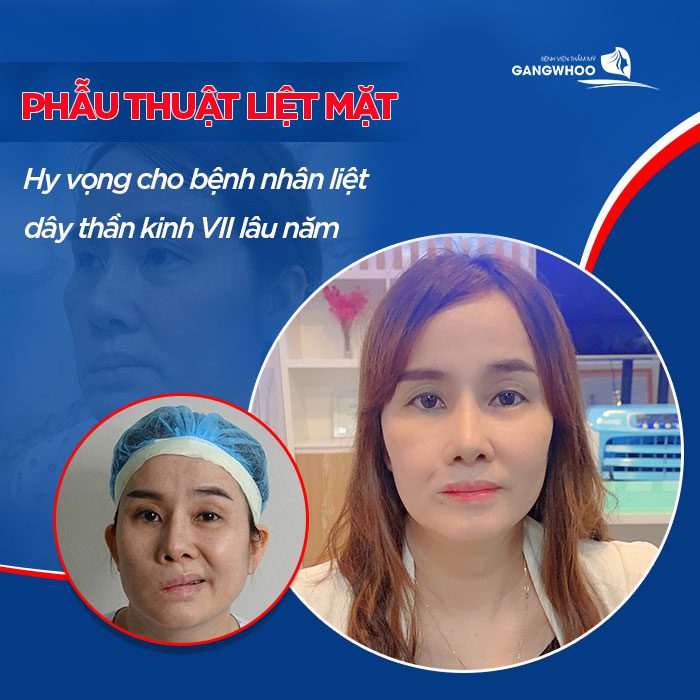 Facial Paralysis Surgery Treatment