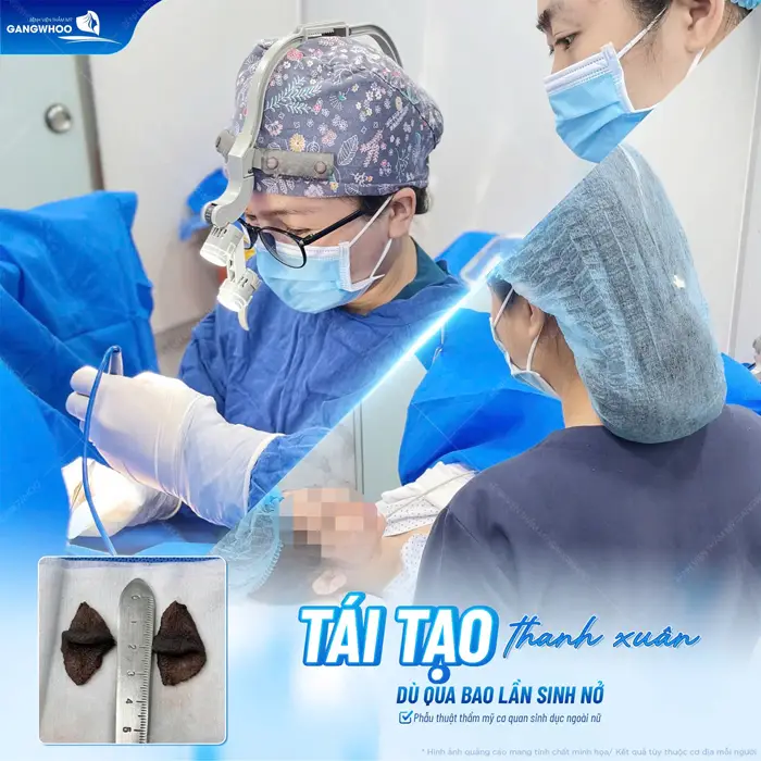 Tái tạo thanh xuân qua nhiều lần sinh nở cải thiện với 1 ca phẫu thuật thẩm mỹ cơ quan sinh dục ngoài nữ