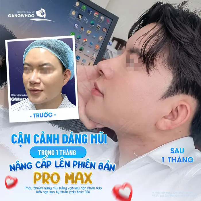 Cận cảnh dáng mũi trogn 1 tháng nâng cấp lên phiên bản hoàn hảo từ sắc vóc đến diện mạo đều thay đổi đến bất ngờ
