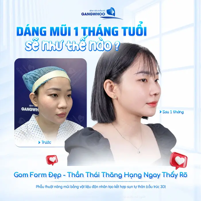 Dáng mũi 1 tháng tuổi gom form đẹp chuẩn, thần thái thăng hạng ngay thấy rõ