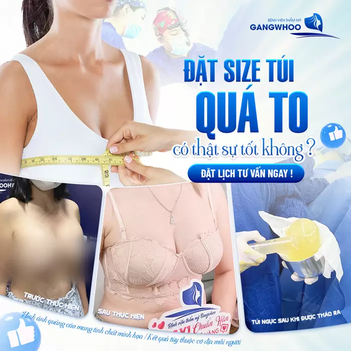 Bác Sĩ Phùng Mạnh Cường Phân Tích Chọn Size Ngực Và Ưu Điểm Của Túi Ngực Nano 2 Chọn size túi ngực thế nào là phù hợp có phải túi ngực càng to càng tốt không