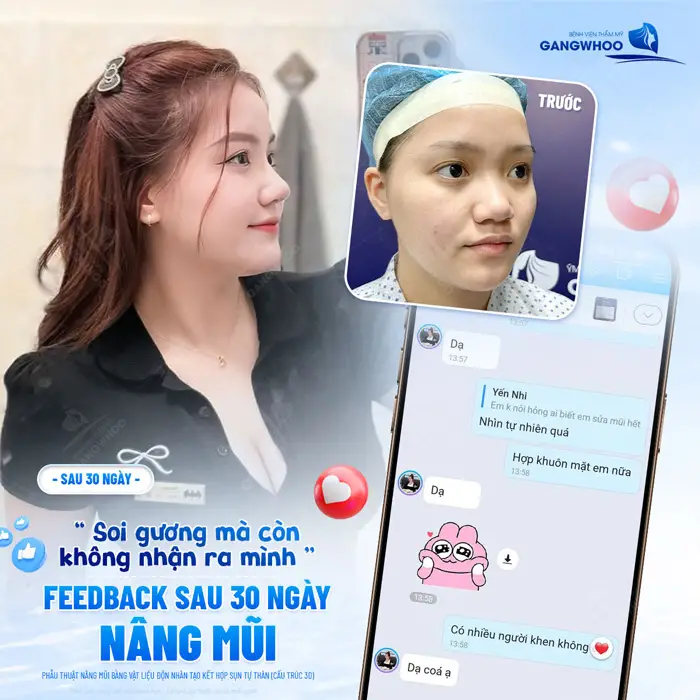 5+ Địa Chỉ Nâng Mũi Uy Tín Tại TPHCM