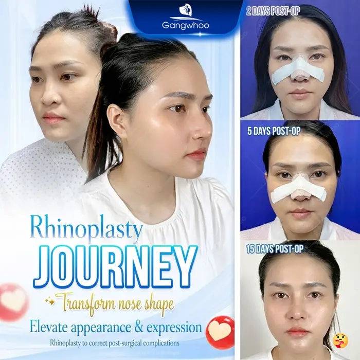 en bs nang mui gioi tai tphcm 2