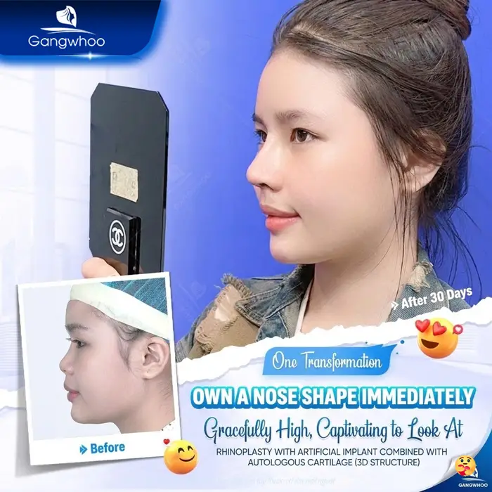 en bs nang mui gioi tai tphcm 3