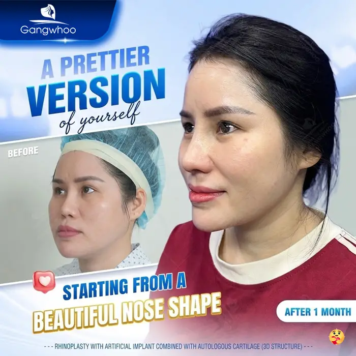 en bs nang mui gioi tai tphcm 4