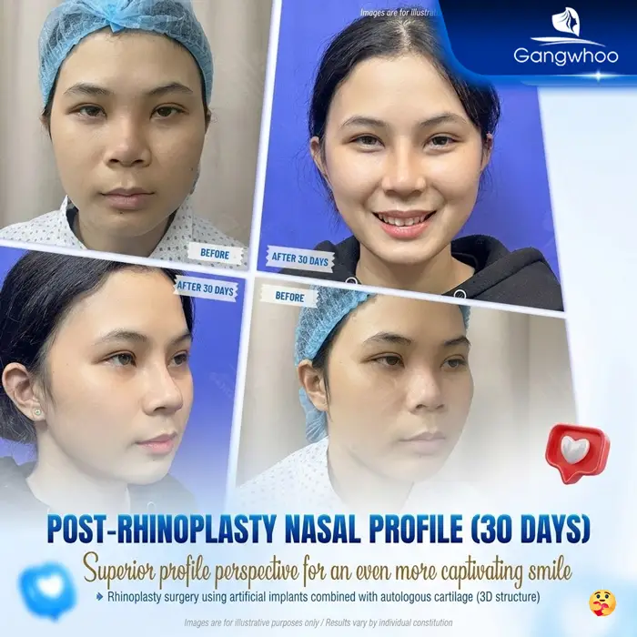 en bs nang mui gioi tai tphcm 5