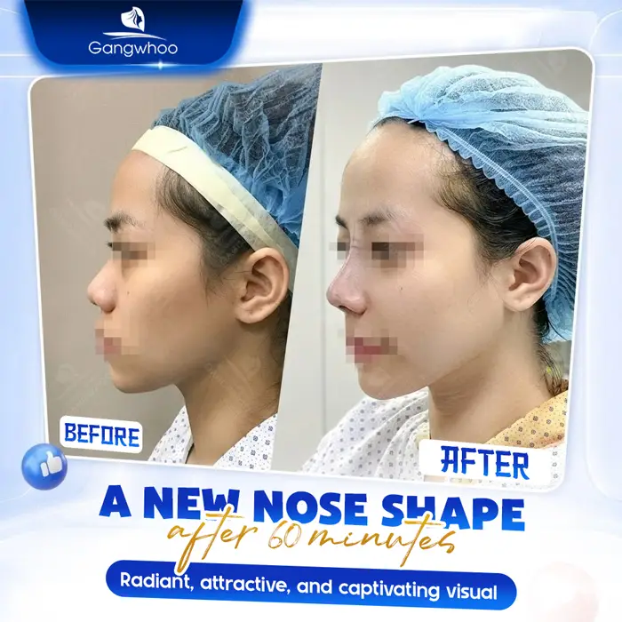 en bs nang mui gioi tai tphcm 6