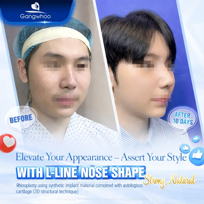 en dia chi nang mui cho nam dep 2