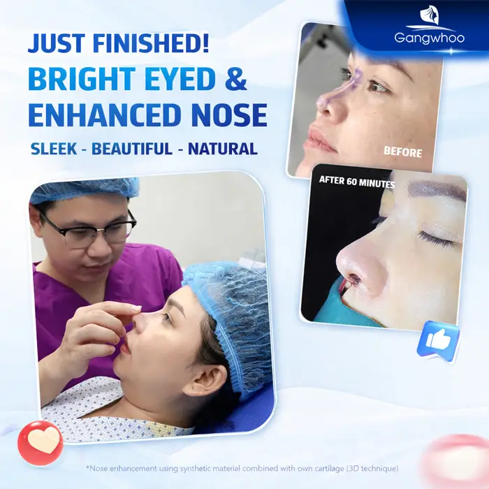 en gia nang mui han quoc 2