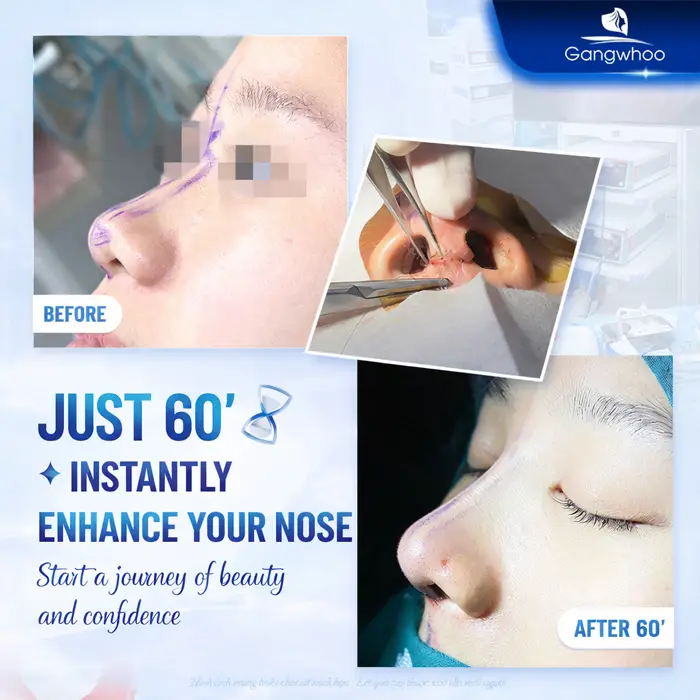 en gia nang mui han quoc 3