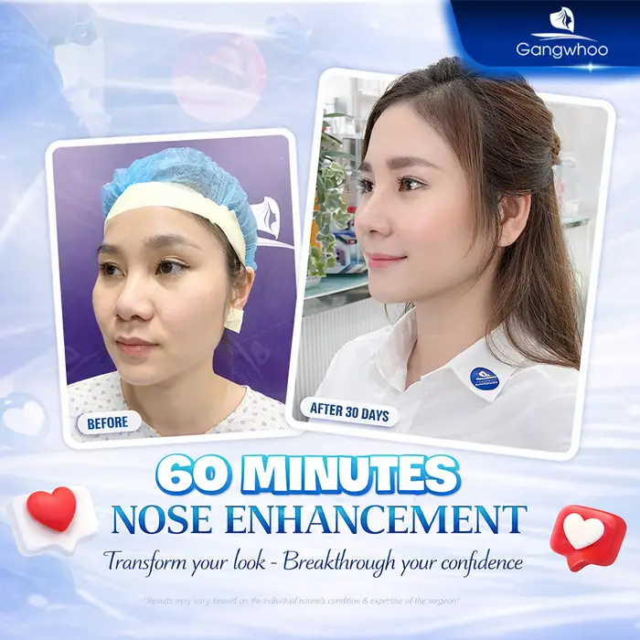 en gia nang mui han quoc 5