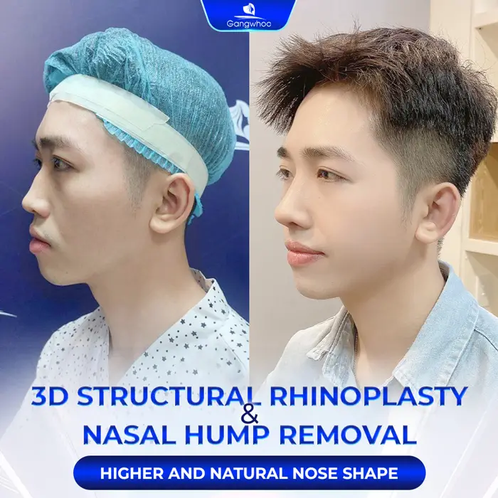 en nang mui l line 1