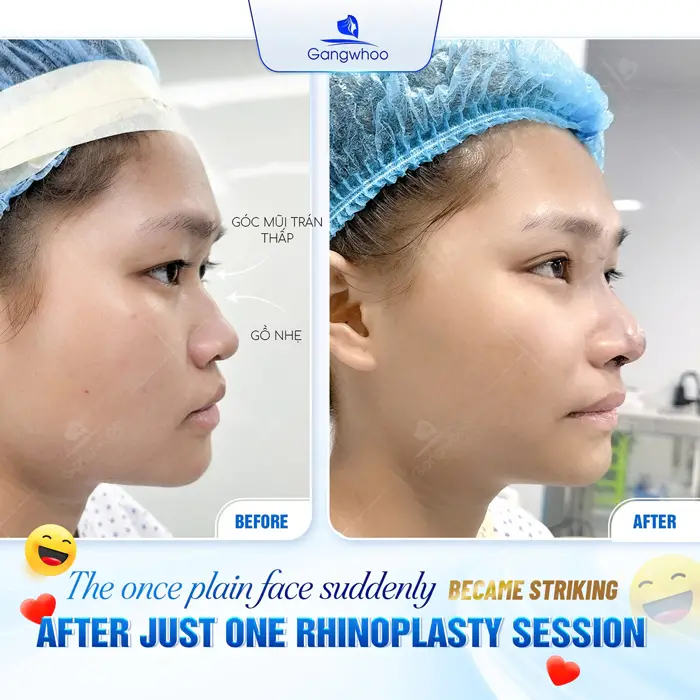 en nang mui l line 4