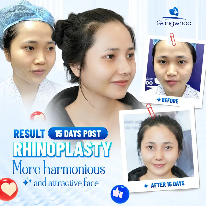 en nang mui l line 6