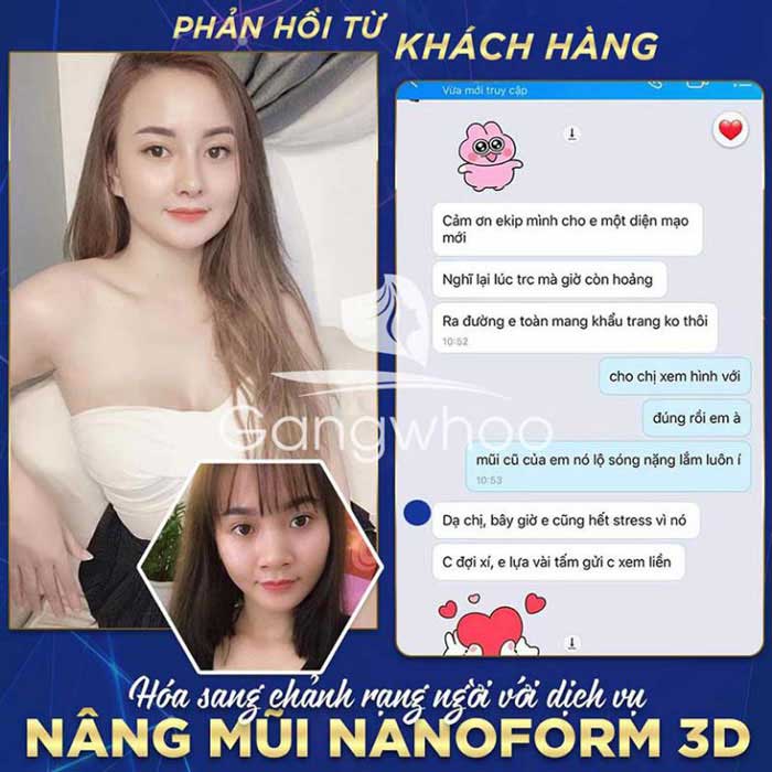 feedback khach hang nang mui nanofrom tmv gangwhoo 1 768x768 1
