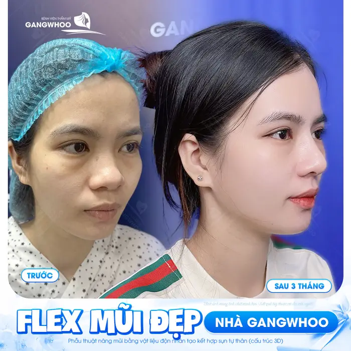 flex mui dep nha gangwhoo 1