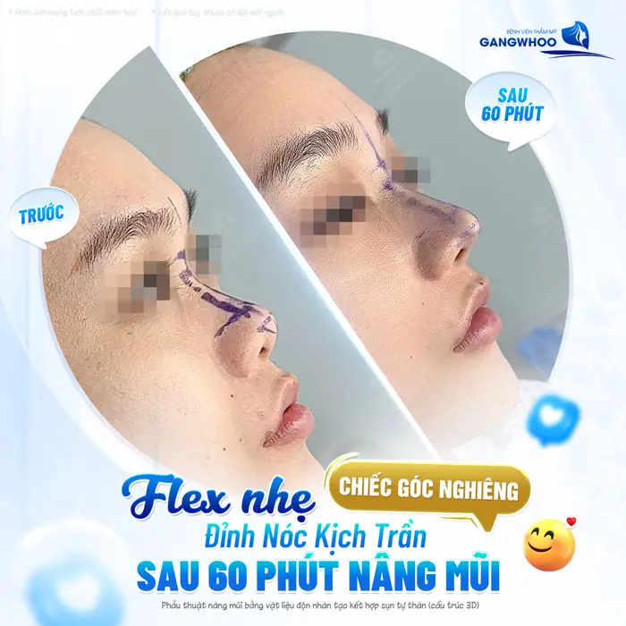 Flex nhẹ góc nghiêng đẹp chấn động sau 60 phút nhan sắc đã thay đổi đẹp hài hòa và cuốn hút hơn
