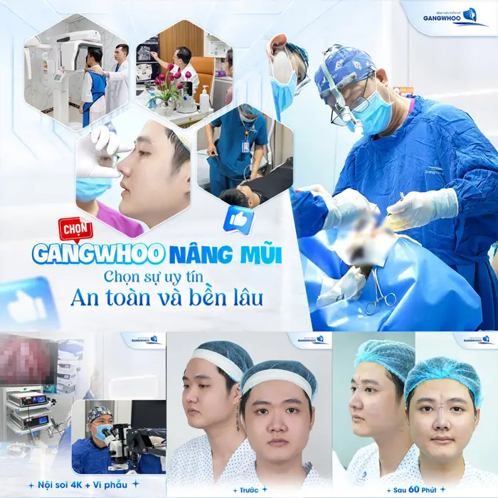 Nâng Mũi Bọc Sụn Được Bao Lâu? Cách Chăm Sóc Duy Trì Lâu Dài 3 Nâng mũi tại Gangwhoo chon sự uy tín, an toàn và đẹp bền lâu